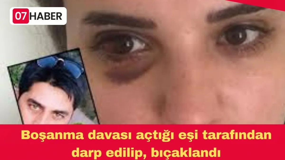 Boşanma davası açtığı eşi tarafından darp edilip, bıçaklandı